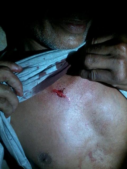Homem é esfaqueado ao se recusar a entregar dinheiro a gangue em Vlhena