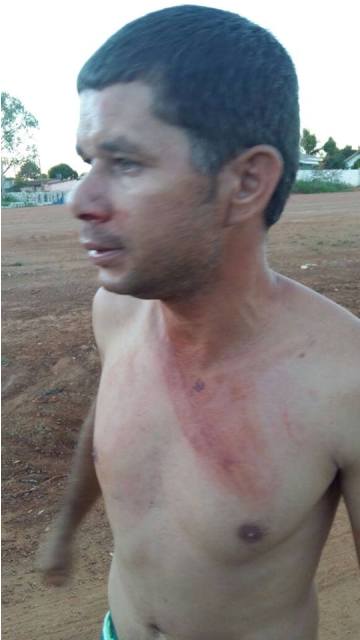 Pedestre bêbado espanca motorista bêbado após escapar de atropelamento