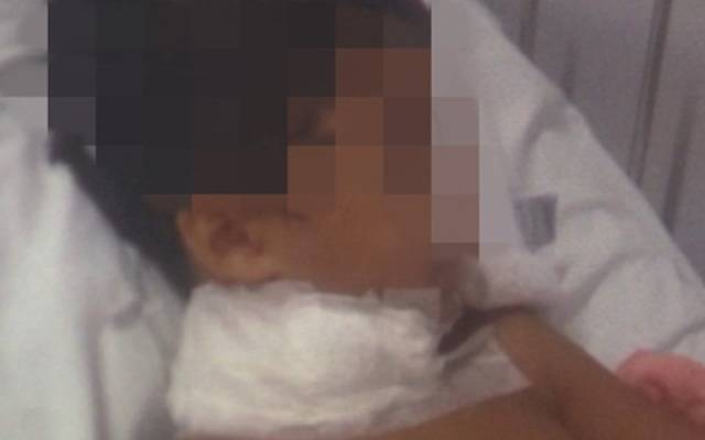 Garoto de RO que teve pescoço atingido por linha de pipa com cerol continua na UTI
