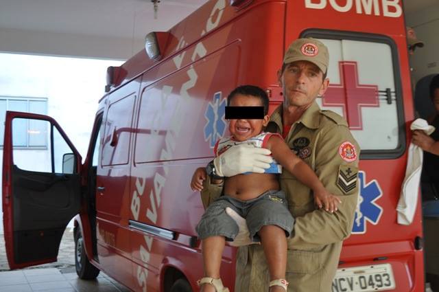 Família se descuida e menino de 2 anos tem rosto atingido por água fervente