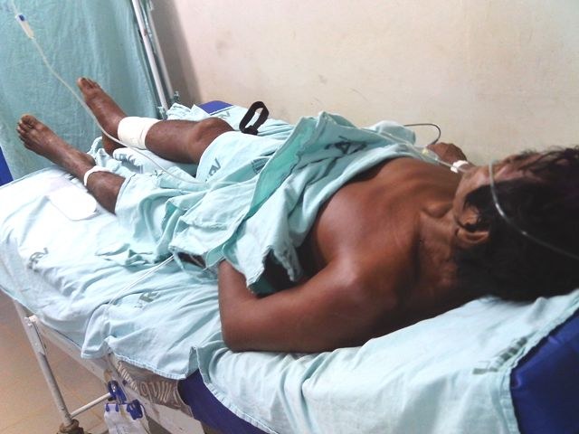 INDIO PICADO POR CASCAVEL MORRE NO HOSPITAL REGIONAL