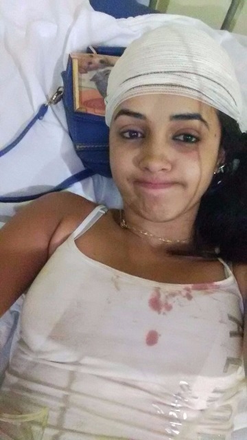 Deixa hospital a jovem que desmaiou após acidente entre Pimenteiras e Cerejeiras
