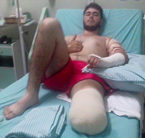 Rapaz de Colorado do Oeste tem perna amputada, mas perdoa causador do acidente