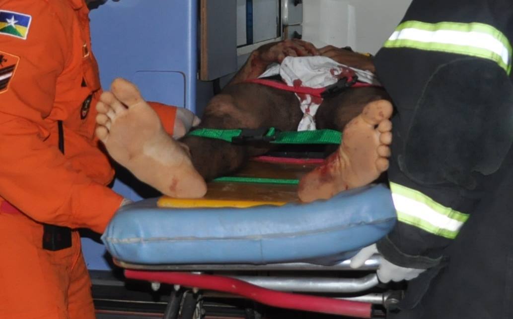 Baleado por desconhecidos, rapaz passa por cirurgia no Hospital Regional de Vilhena