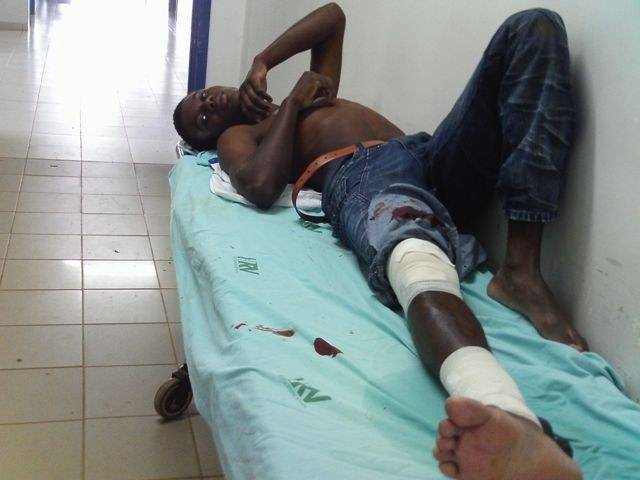 AZAR EM DOSE DUPLA: JOVEM QUEBRA PERNA COM MOTO NOVA