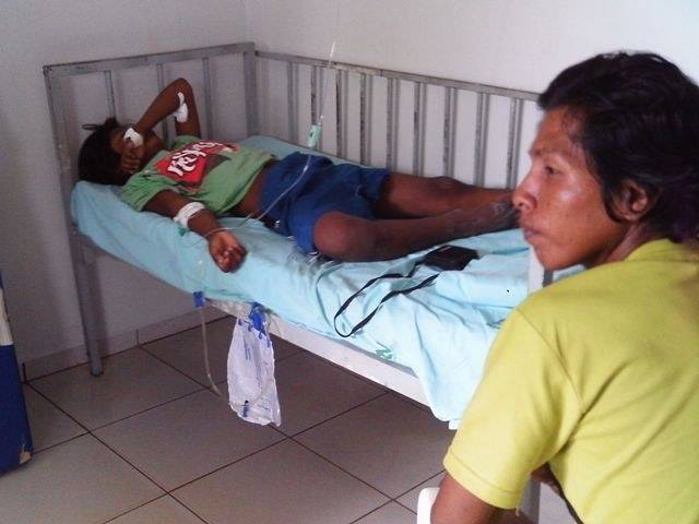 INDIO DE 11 ANOS É SALVO POR PAJELANÇA APÓS SER PICADO POR CASCAVEL