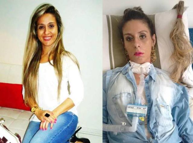 Enfrentando doença sem cura, vilhenense doa cabelo para hospital de câncer