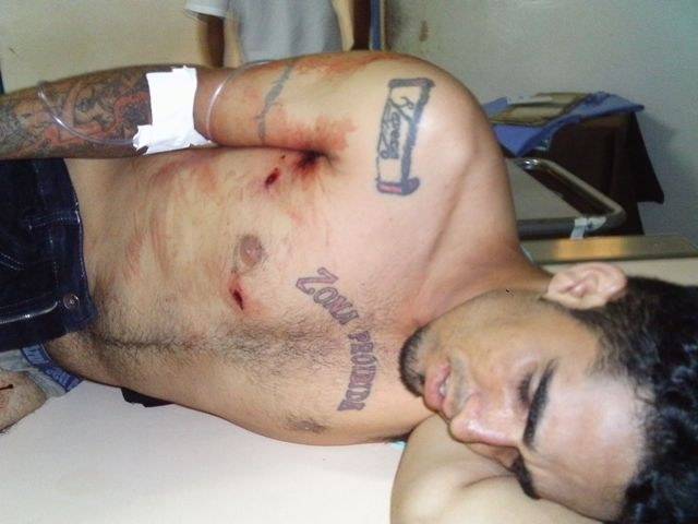 JOVEM LEVA SEIS TIROS E SOBREVIVE; SEGURANÇA DE CASA NOTURNA É SUSPEITO