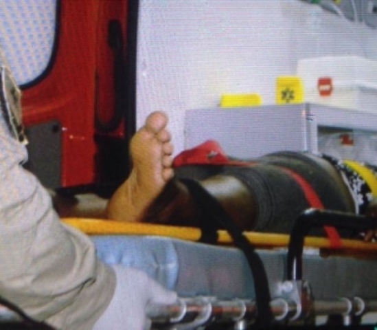 Mulher de 28 anos baleada em Vilhena perde um dos rins e movimento das pernas
