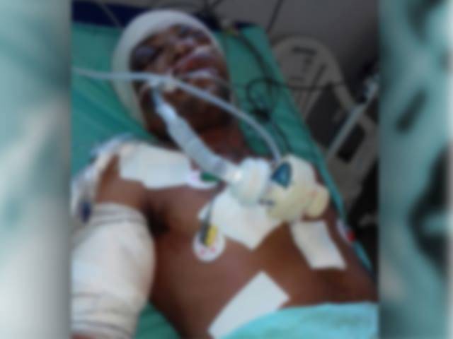 Desconhecido agredido na madrugada em Vilhena segue em estado grave para Cacoal