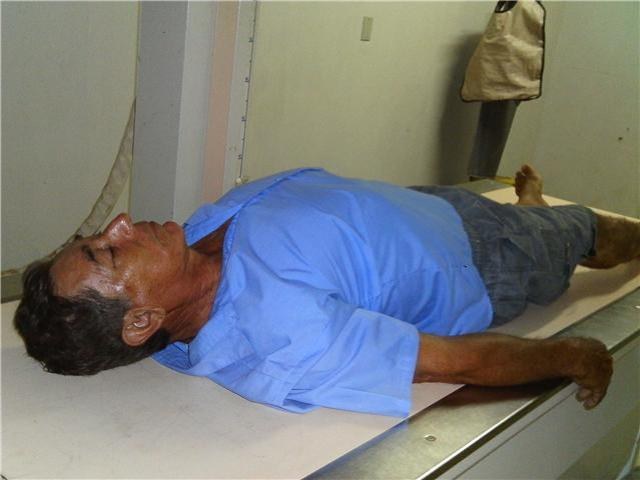 FAZENDEIRO CAI DE CAVALO E VAI PARAR NO HOSPITAL