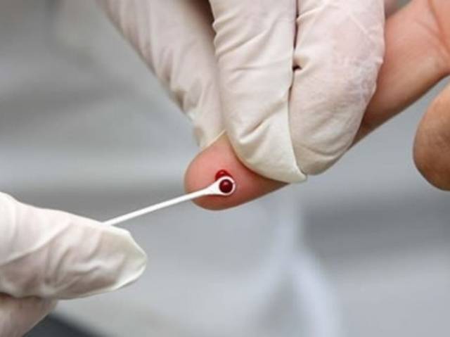 Casos de Aids disparam em cidade da região e Vilhena pode registrar contágio em massa