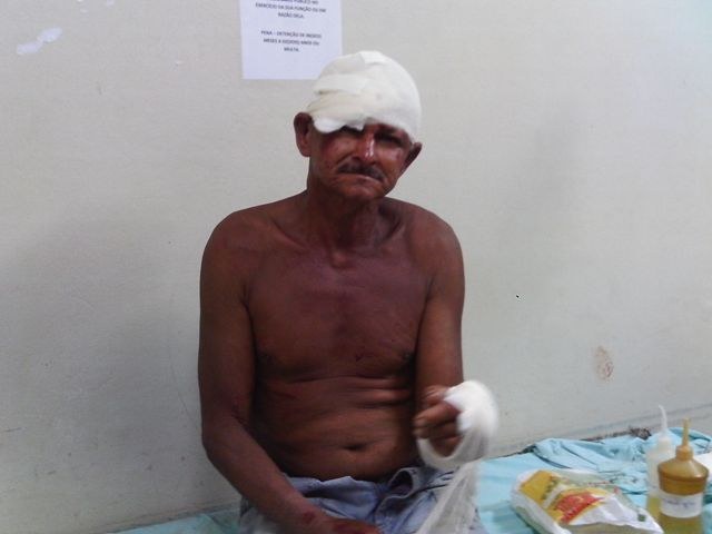 IDOSO É ESPANCADO E AMORDAÇADO COM A PRÓPRIA CUECA EM VILHENA