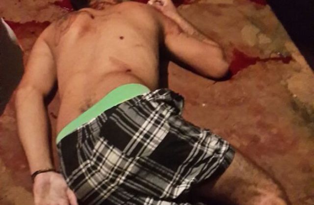 Morre no hospital rapaz de 18 anos que havia sobrevivido a tiros na cabeça em Vilhena