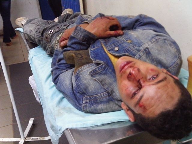 JOVEM É ATACADO POR GANGUE, QUE LEVA SUA BICICLETA E R$ 100
