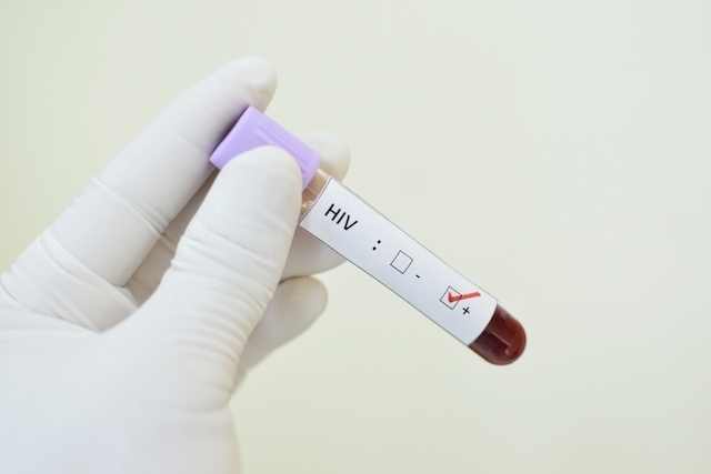 Cone Sul tem mais de 2 mil portadores do HIV; sífilis recua, mas outras DSTs preocupam 