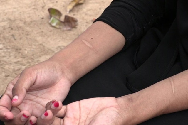 “Encontrei minha filha com um fio no pescoço tentando se matar”, desabafa vilhenense sobre depressão