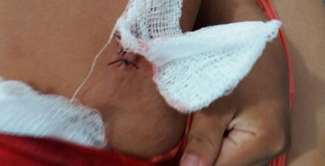 Selvageria em Colorado do Oeste: faxineira de 23 anos é atacada por 8 homens e esfaqueada; um foi preso