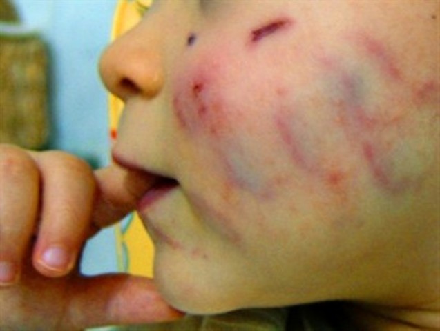 Justiça mantém presa pastora evangélica acusada de aconselhar mulher a açoitar filha de 8 anos em Cerejeiras