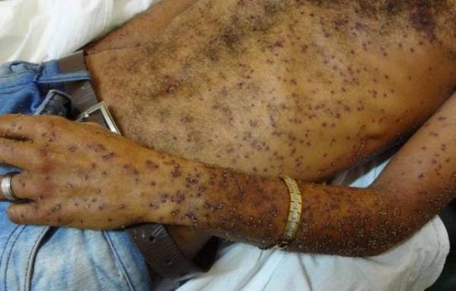 Após picar cachorro e assustar dona de casa, enxame de abelhas ataca homem de 63 anos em Vilhena