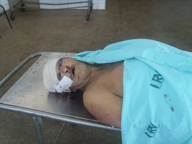 IDOSO MORRE AO SER ATROPELADO POR IRMÃO DE EX-VEREADOR