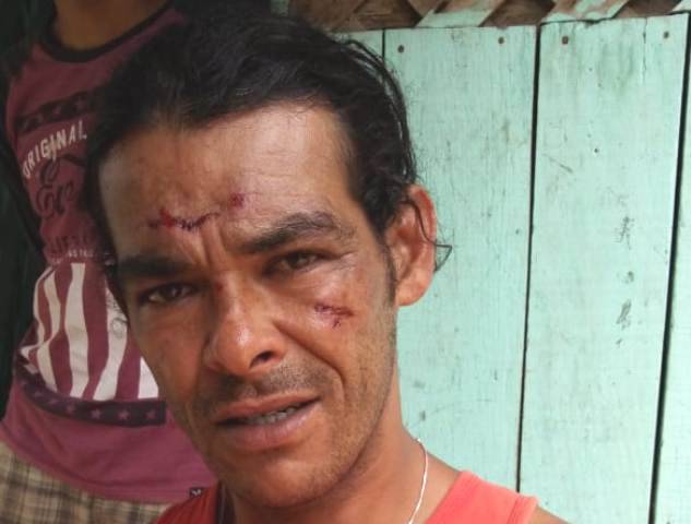 ASSISTA: pedreiro grava vídeo e vai ao MP acusando policiais de agressão; PMs negam e registram queixa por desobediência