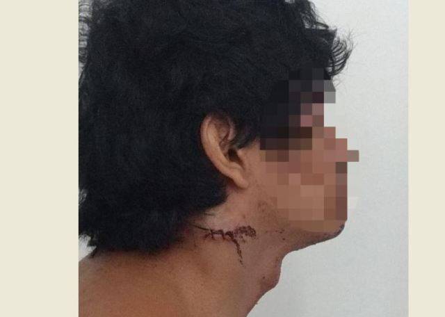 Alvo de investigação da Polícia Federal contra pornografia infantil em Rondônia corta o próprio pescoço