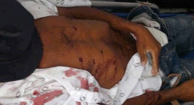 Homem faz comentário sobre prostituta e é assassinado com tiro no peito na área rural de Chupinguaia