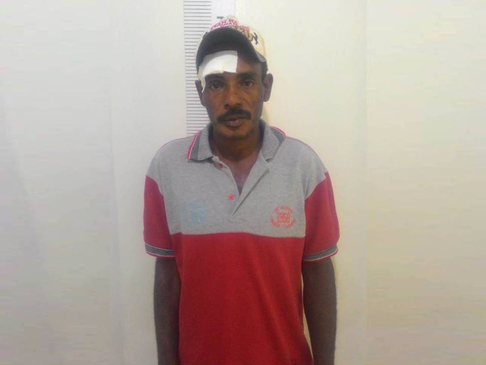 Deu ruim: Homem sofre queda de bicicleta, procura atendimento médico e acaba preso pela Polícia Civil