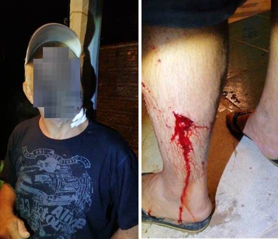 Vítima de tentativa de homicídio no dia 06 de janeiro, homem volta a ser baleado em Vilhena