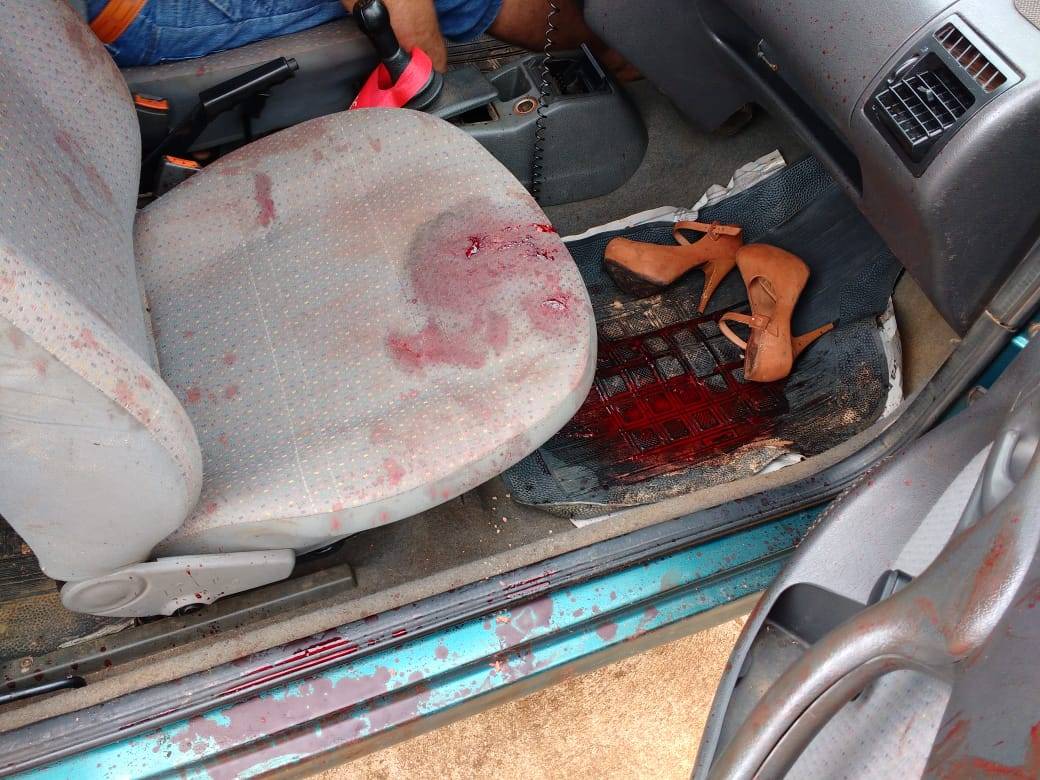 Vilhena: mulher de 33 anos baleada no rosto por segurança será transferida para hospital de Cacoal; ex-marido está preso