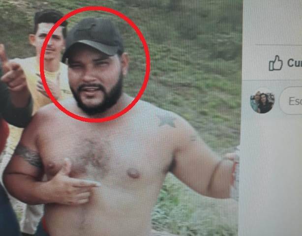 Segurança que atirou no rosto de mulher de 33 anos em Vilhena tem prisão decretada, mas continua foragido