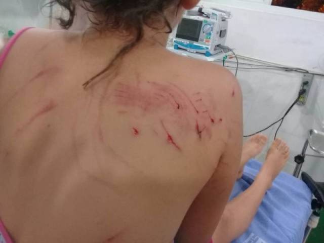 Promotor de justiça instaura inquérito para conter ataques violentos de animais soltos nas ruas de Vilhena