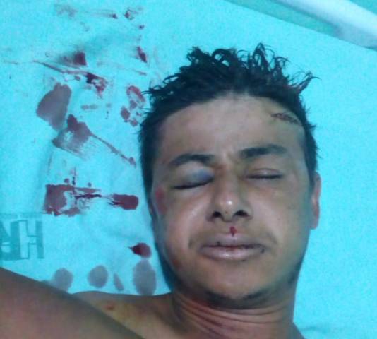 Vilhena: rapaz com problemas mentais é atingido por carro e populares espancam atropelador, que estaria embriagado