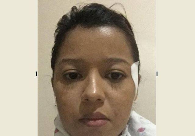 Enfrentando doença rara, cabeleireira vilhenense cria “Vakinha” para tentar fazer cirurgia de R$ 50 mil