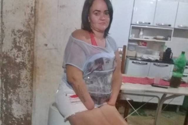 Mulher que teve as duas mãos amputadas pelo marido em cidade do MT revela detalhes da brutalidade e pede ajuda