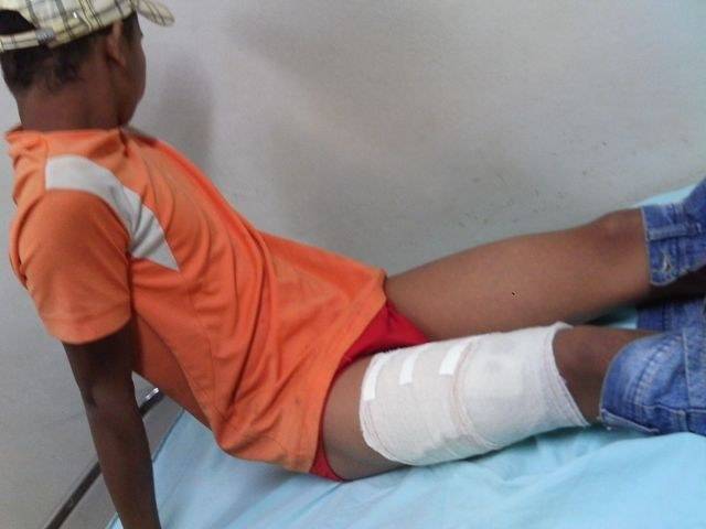 ADOLESCENTE ENTRA EM BRIGA DE TIOS E ACABA BALEADO EM CEREJEIRAS