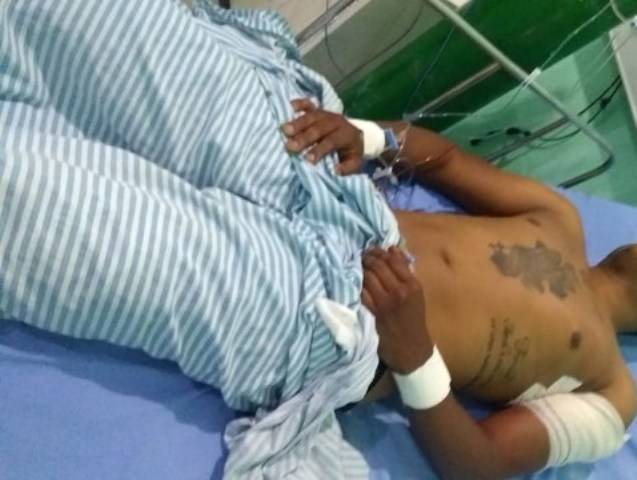 Vilhena: rapaz de 21 anos esfaqueado por dívida reconhece autor do crime através de foto; comparsa escapou