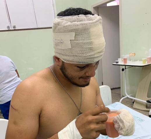 Jovem que caiu de uma altura de 4 metros consertando em ar-condicionado em Cerejeiras sai do coma e já se alimenta sozinho