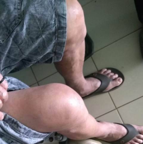 Carros “fecham” bicicleta, derrubam aposentado de 78 anos e motoristas fogem sem prestar socorro