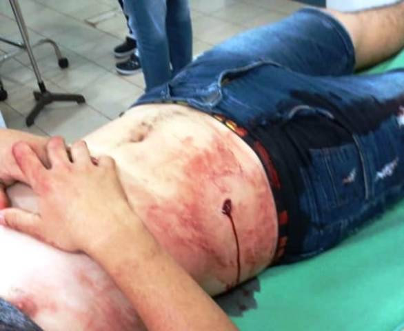 Caminhoneiro de 23 anos é esfaqueado ao tentar separar briga iniciada por causa de mulher