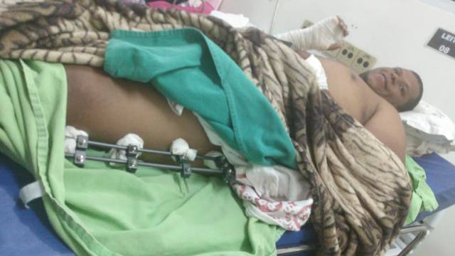 Saiba como ajudar: familiares de agente penitenciário atropelado por “Uber” pedem ajuda após cirurgia de emergência “no fiado”