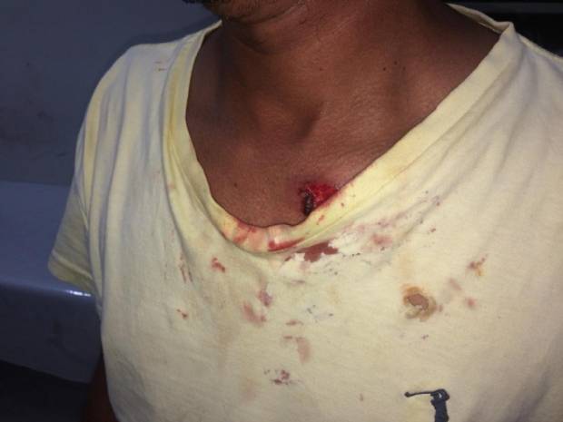 Homem baleado em Chupinguaia é trazido para Vilhena; vítima havia se mudado para a cidade recentemente
