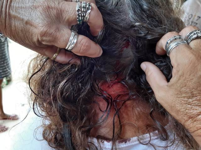 Casal de ladrões invade residência, rende marido, espanca mulher e foge levando motoneta das vítimas