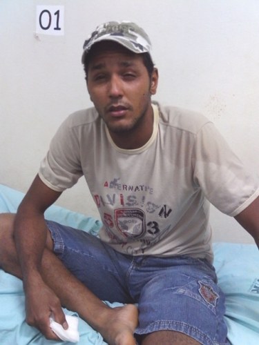 Eletricista acredita em mito e tem olho atingido por sangue de cobra