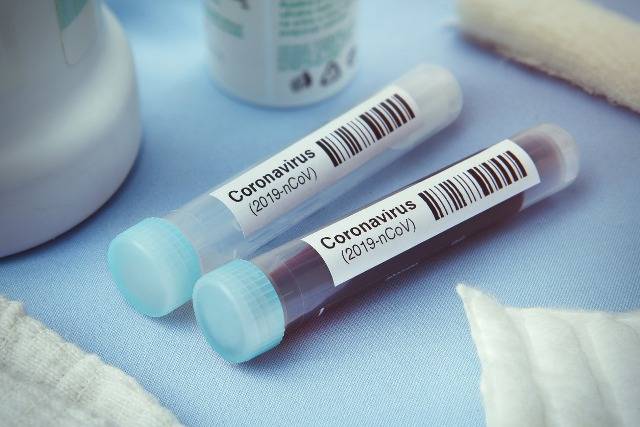 Secretaria Municipal de Saúde de Vilhena compra testes rápidos de Covid-19 para acelerar diagnósticos na cidade