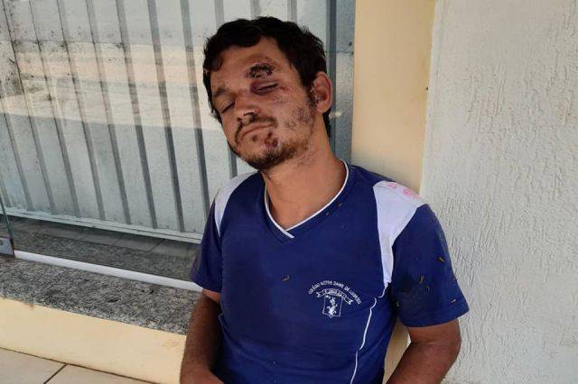 Empresário resgata morador de Rondônia ferido nas ruas de Cuiabá; internauta diz que ele passou por Vilhena