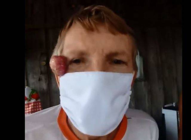 ASSISTA E AJUDE: com tumor no rosto e problemas nos pulmões, aposentado do Cone Sul grava vídeo para pedir ajuda
