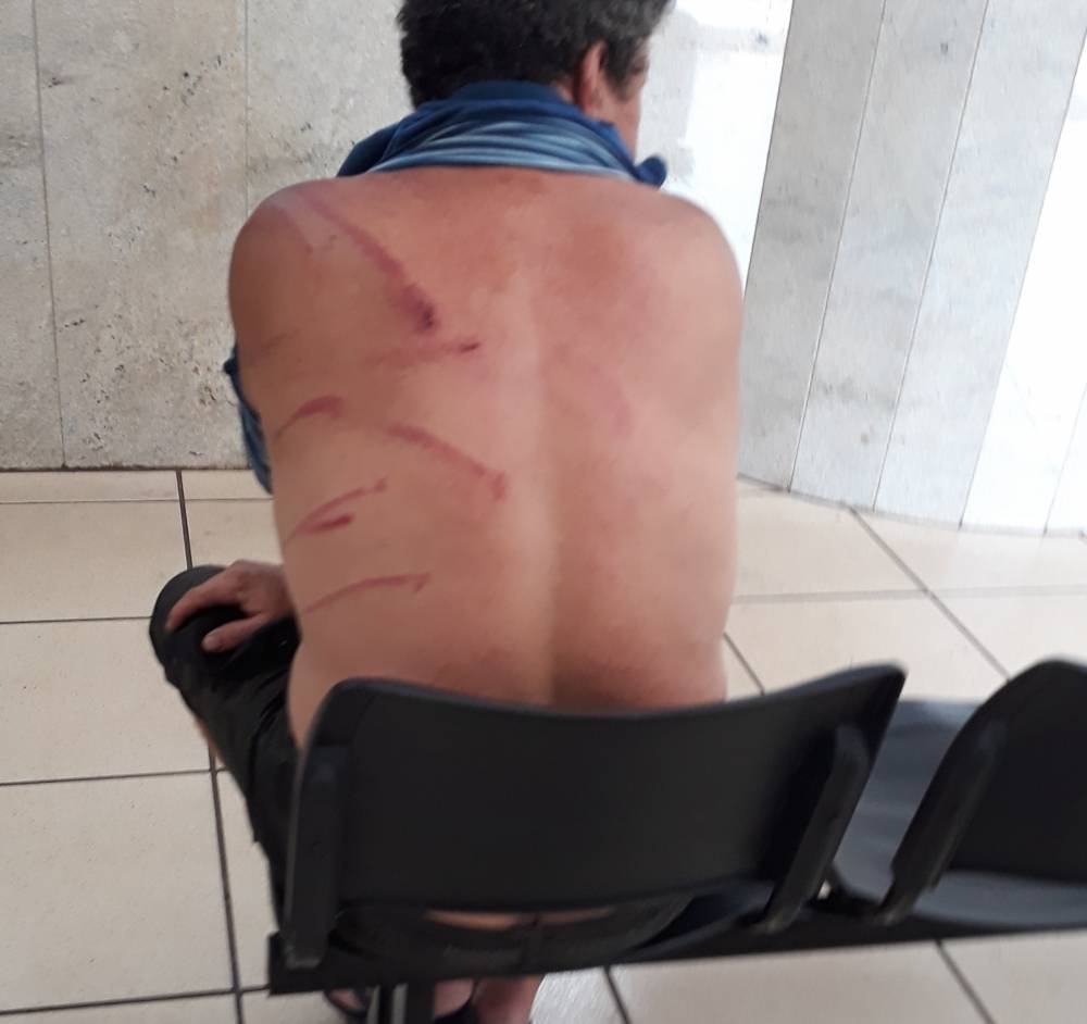 Autônomo é perseguido, espancado e ameaçado de morte por supostos membros do PCC por causa de dívida de drogas de R$ 200