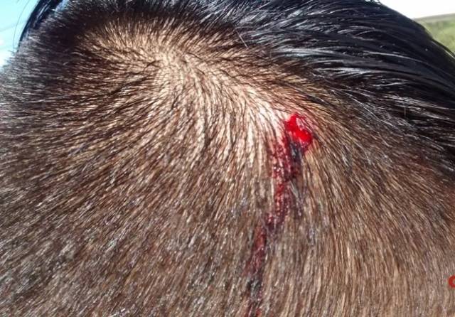Funcionário de churrascaria é atacado a golpe de rodo e clientes do estabelecimento dominam o agressor